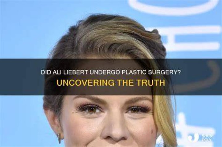 Ali Liebert Plastic Surgery Facelift, Lips, Botox, and More