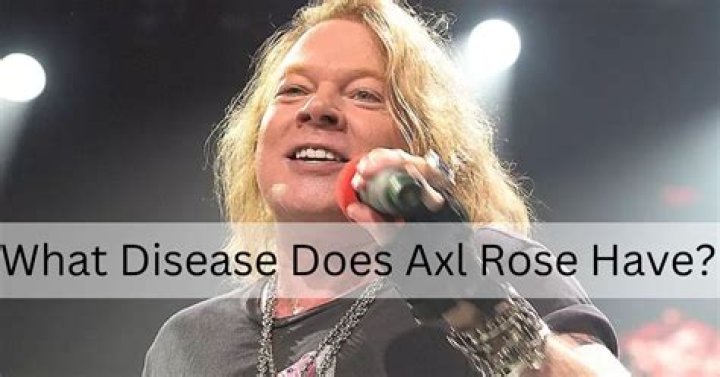Axl Rose&rsquo;s Illness, and Health Recovery 2023 How the Rock Legend