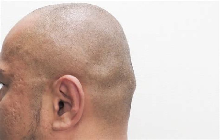 back+of+head (image)