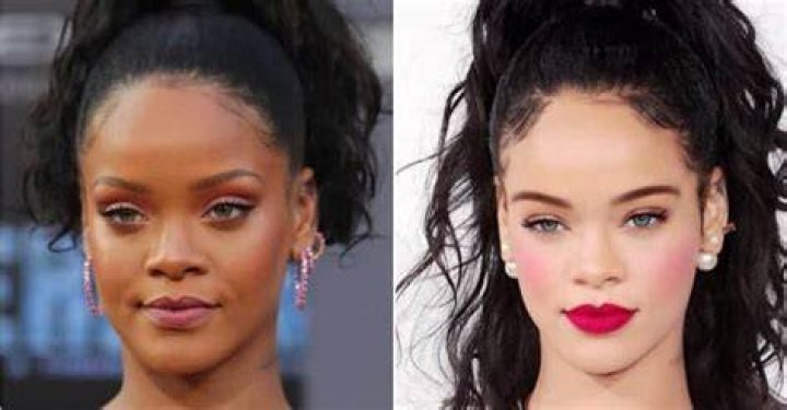 celebrities that bleach their skin