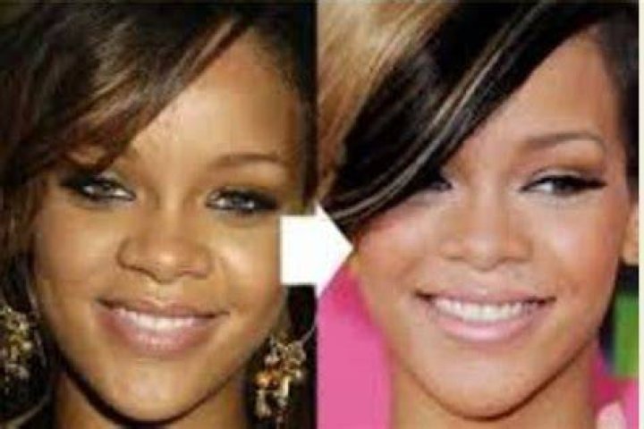 celebrities who bleach their skin