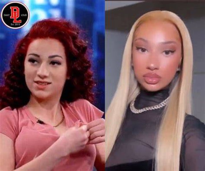 Female Rapper BHAD BHABIE Get Skin Darkening Procedure Now She's A